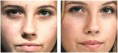 /album/fotogalerie-chemicky-peeling/chemicky-peeling-pred-po-jpg/